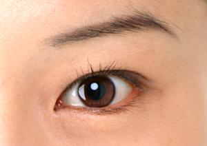 脂肪吸引の安全性と効果を徹底解説！成功する施術のポイント